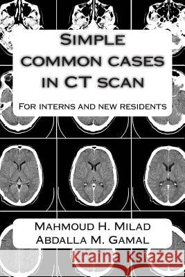 Simple common cases in CT scan: For interns and new residents Gamal, Abdalla M. 9781514709962 Createspace