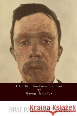 A Practical Treatise on Smallpox George Henry Fox 9781514879757 Createspace