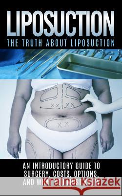 Liposuction: The Truth About Liposuction: An Introductory Guide to Surgery, Costs, Options, And What You Must Know Hendrix, Arnold 9781515378228 Createspace