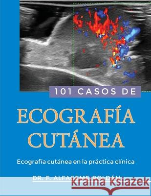 101 Casos de Ecografia Cutanea: Ecografía cutánea en la práctica clínica Roldán, Fernando Alfageme 9781516800483 Createspace Independent Publishing Platform
