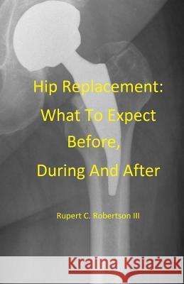 Hip Replacement: What To Expect Before, During and After Robertson, Rupert C. 9781517462307 Createspace