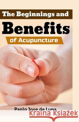 The Beginnings and Benefits of Acupuncture Paolo Jos 9781519270603 Createspace