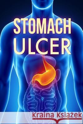Stomach Ulcer: Treatment in 60 days!: Stomach Ulcer treatment Jonathan, David L. 9781519568281 Createspace Independent Publishing Platform