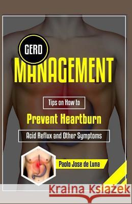 GERD Management: Tips On How To Prevent Heartburn, Acid Reflux And Other Symptoms Jose De Luna, Paolo 9781519627292 Createspace Independent Publishing Platform