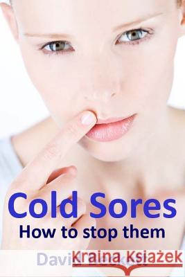 Cold Sores: How to stop them Beckett, David 9781519637260 Createspace Independent Publishing Platform
