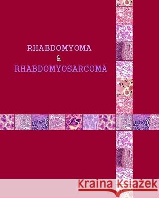 Rhabdomyoma & Rhabdomyosarcoma Naira Roland Matevosyan 9781519713018 Createspace Independent Publishing Platform