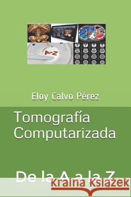 Tomografía Computarizada: De la A a la Z Calvo Pérez, Eloy 9781520766225 Independently Published