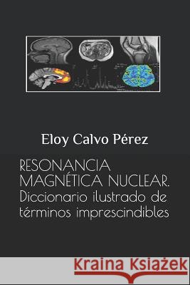 Resonancia Magnética Nuclear: Diccionario ilustrado de términos imprescindibles Calvo Pérez, Eloy 9781520790381 Independently Published