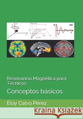 Resonancia Magnética para Técnicos: Conceptos básicos Calvo Pérez, Eloy 9781520879116 Independently Published