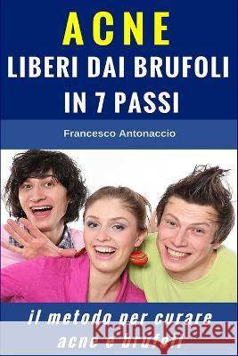 Acne liberi dai brufoli in 7 passi: Il metodo per curare acne e brufoli Francesco Antonaccio 9781522741312 Createspace Independent Publishing Platform