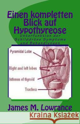 Einen kompletten Blick auf Hypothyreose: Unterfunktion der Schilddrüse Symptome und Behandlungen Lowrance, James M. 9781523220670 Createspace Independent Publishing Platform