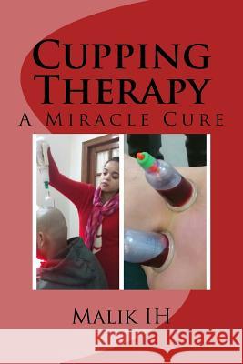 Cupping Therapy: A Miracle Cure Malik Ih Sana Ahmad 9781523687169 Createspace Independent Publishing Platform