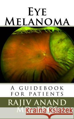 Eye Melanoma: A manual for patients Anand MD, Rajiv 9781523912155 Createspace Independent Publishing Platform