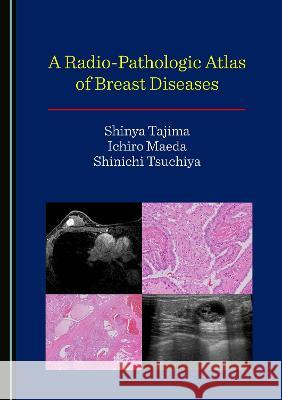 A Radio-Pathologic Atlas of Breast Diseases Shinya Tajima Ichiro Maeda Shinichi Tsuchiya 9781527501041 Cambridge Scholars Publishing