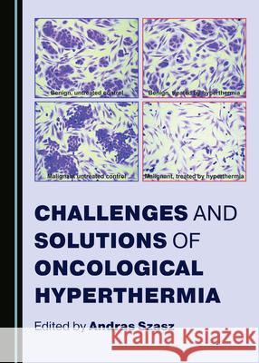 Challenges and Solutions of Oncological Hyperthermia Andras Szasz 9781527548176