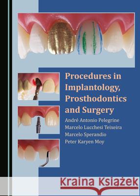 Procedures in Implantology, Prosthodontics and Surgery Andre Antonio Pelegrine Marcelo Lucchesi Teixeira Marcelo Sperandio 9781527569775