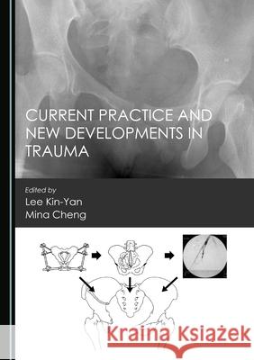 Current Practice and New Developments in Trauma Lee Kin-Yan Mina Cheng 9781527574199 Cambridge Scholars Publishing