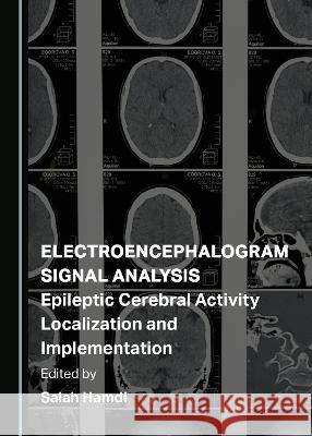 Electroencephalogram Signal Analysis: Epileptic Cerebral Activity Localization and Implementation Salah Hamdi   9781527584518