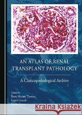 An Atlas of Renal Transplant Pathology: A Clinicopathological Archive Renu Mariam Thomas Kartik Ganesh Sunita Simon 9781527592216 Cambridge Scholars Publishing