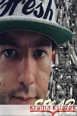 Skab: Skin and Bones with a Few Closed Wounds Scotty Lincoln Lori Draft Trevor Skrocki 9781530063123 Createspace Independent Publishing Platform