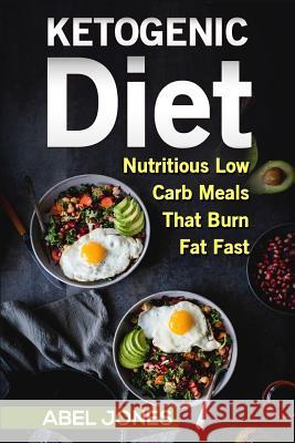The Ketogenic Diet: The 50 BEST Low Carb Recipes That Burn Fat Fast Plus One Full Month Meal Plan Evans, Abel 9781530669370