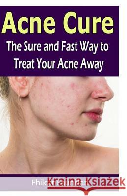 Acne Cure: The Sure and Fast Way to Treat Your Acne Away Fhilcar Faunillan 9781530742318 Createspace Independent Publishing Platform