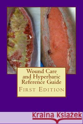 Wound Care and Hyperbaric Reference Guide Dimitrios P. Lintzeri 9781530982479 Createspace Independent Publishing Platform