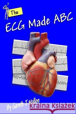 The ECG Made ABC MR Gareth J. Mallon Gareth J. Mallon 9781530982523 Createspace Independent Publishing Platform