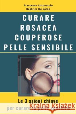 Curare Rosacea Couperose e Pelle Sensibile: Le 3 azioni chiave per curare la pelle sensibile Beatrice d Francesco Antonaccio 9781532774638 Createspace Independent Publishing Platform