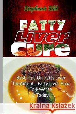Fatty Liver Cure: Best Tips on Fatty Liver Treatment... Fatty Liver How to Reverse It Today! Stephanie Ridd 9781532955112 Createspace Independent Publishing Platform