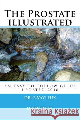 The Prostate illustrated: In 10 points Vayleux, Bertrand 9781533218834