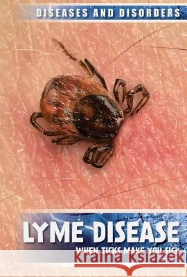 Lyme Disease: When Ticks Make You Sick Raymond J. Lampke 9781534563629 Lucent Press