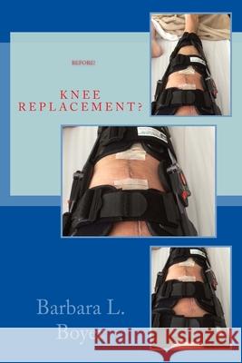 Read This BEFORE Your Knee Replacement Barbara L. Boyer 9781535073592