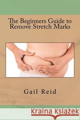 The Beginners Guide to Remove Stretch Marks Gail Reid 9781535245692