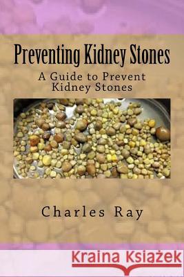 Preventing Kidney Stones: A Guide to Prevent Kidney Stones Charles Ray 9781535262385 Createspace Independent Publishing Platform