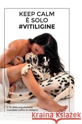 Keep Calm È Solo #Vitiligine Chemolli, Erica 9781535418119