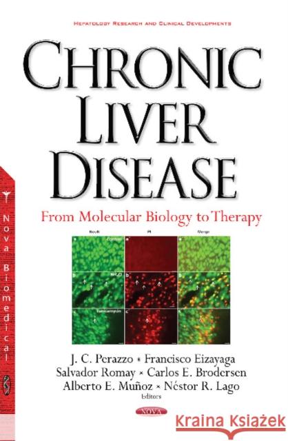 Chronic Liver Disease: From Molecular Biology to Therapy J C Perazzo, Francisco Eizayaga, Salvador Romay, Carlos E Brodersen, Alberto E Muñoz, Néstor R Lago 9781536102376 Nova Science Publishers Inc