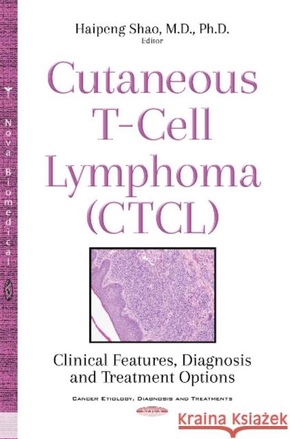 Cutaneous T-Cell Lymphoma (CTCL): Clinical Features, Diagnosis & Treatment Options Haipeng Shao 9781536118995 Nova Science Publishers Inc