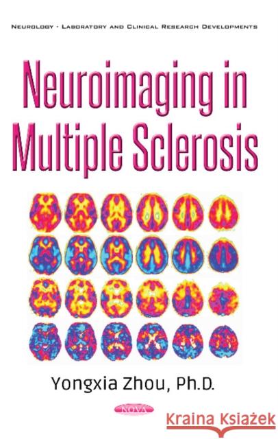 Neuroimaging in Multiple Sclerosis Yongxia Zhou 9781536119480 Nova Science Publishers Inc