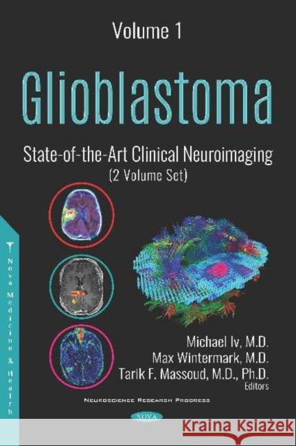 Glioblastoma: State-of-the-Art Clinical Neuroimaging (2 Volume Set) Michael Iv, Max Wintermark, Tarik F. Massoud 9781536145885