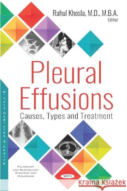 Pleural Effusions: Causes, Types and Treatment Rahul Khosla 9781536146837 Nova Science Publishers Inc (ML)