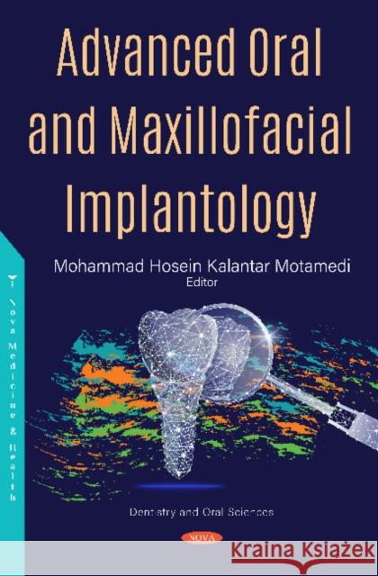 Advanced Oral and Maxillofacial Implantology Mohammad Hosein Kalantar Motamedi 9781536169317