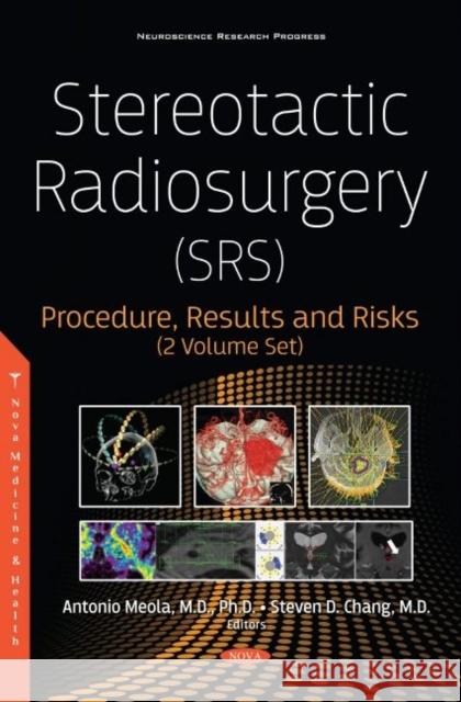 Stereotactic Radiosurgery (SRS): Procedure, Results and Risks (2 Volume Set) Steven D. Chang   9781536176797 Nova Science Publishers Inc