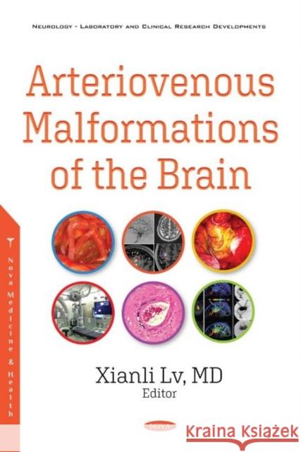 Arteriovenous Malformations of the Brain Xianli Lv   9781536178920 Nova Science Publishers Inc