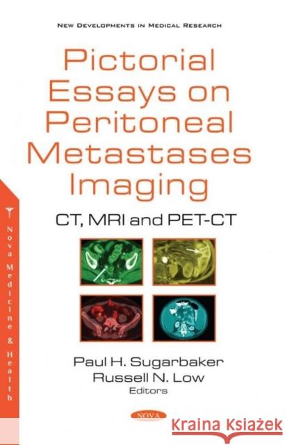 Pictorial Essays on Peritoneal Metastases Imaging: CT, MRI and PET-CT Paul H. Sugarbaker   9781536180145 Nova Science Publishers Inc