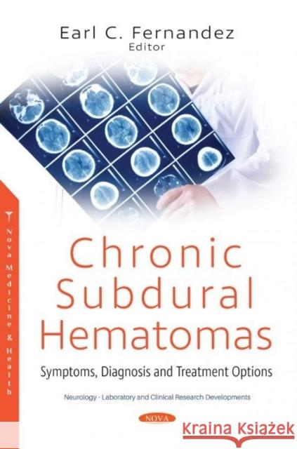 Chronic Subdural Hematomas: Symptoms, Diagnosis and Treatment Options Earl C. Fernandez   9781536184457 Nova Science Publishers Inc