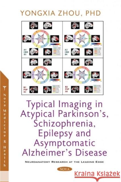 Typical Imaging in Atypical Parkinsons, Schizophrenia, Epilepsy and Asymptomatic Alzheimers Disease Yongxia Zhou 9781536199390 Nova Science Publishers Inc (RJ)