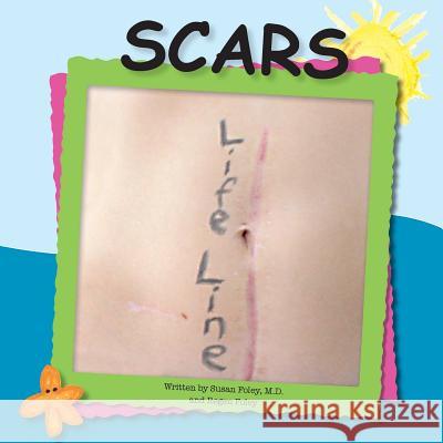 Scars Susan Fole Regen Foley 9781539572589