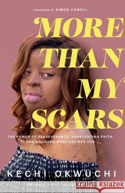 More Than My Scars: The Power of Perseverance, Unrelenting Faith, and Deciding What Defines You Kechi Okwuchi Simon Cowell 9781540901590 Baker Books