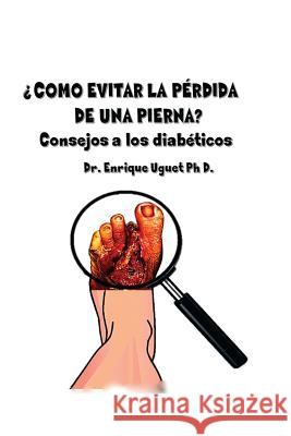 Como evitar la perdida de una pierna: (Color) Consejos a los diabeticos Uguet Ph. D., Enrique 9781541081574 Createspace Independent Publishing Platform